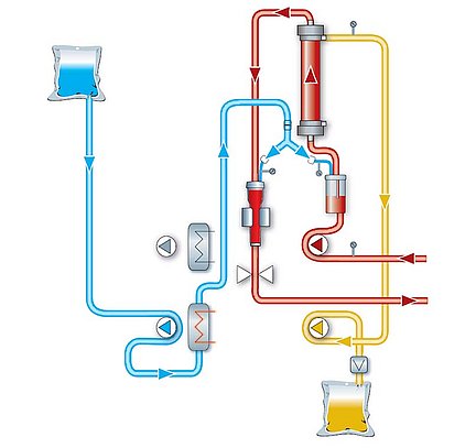 Схема постоянной вено-венозной гемофильтрации