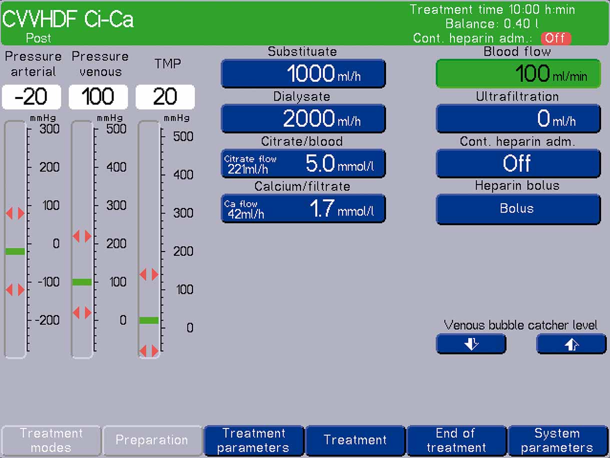 Стандартные настройки аппарата multiFiltrate при проведении процедуры Ci-Ca® postCVVHDF